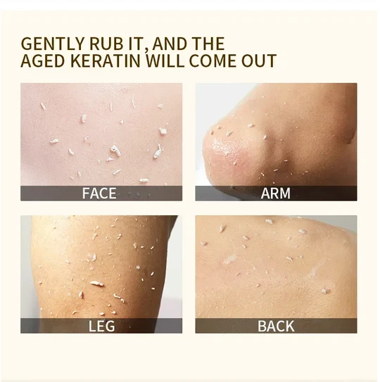 🍊 Limited Time Offer: Buy 1 Get 1 Free! Orange Exfoliating Gel – Gently Removes Dead Skin Cells ✨