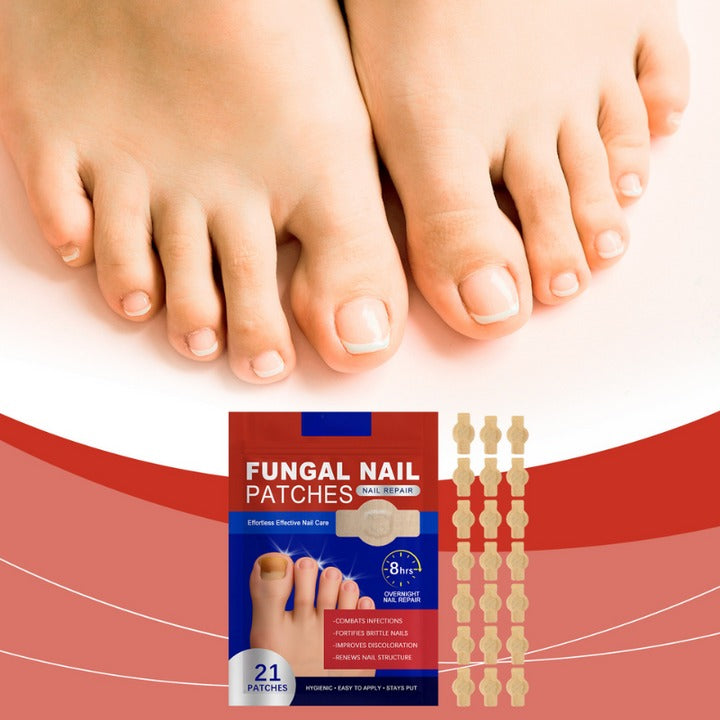 FungalPatch – Intensive Nail Care Set – Self-Adhesive Anti-Fungal Patches