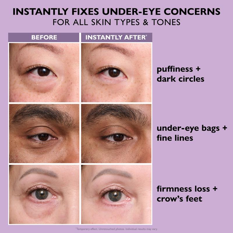 Peter Thomas Roth Instant FirmX – Instant, Temporary Eye Tightener