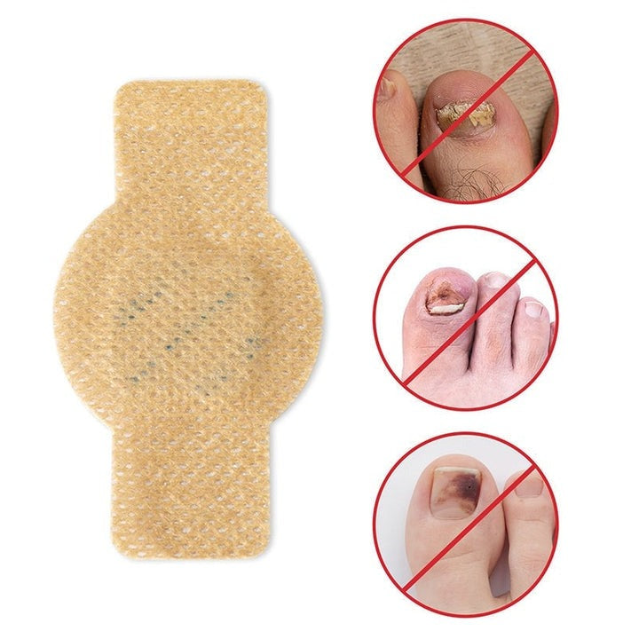 FungalPatch – Intensive Nail Care Set – Self-Adhesive Anti-Fungal Patches