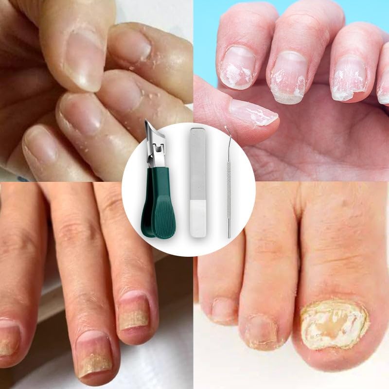 Professional Toenail Clippers for Ingrown and Thick Nails – Eagle Beak Design