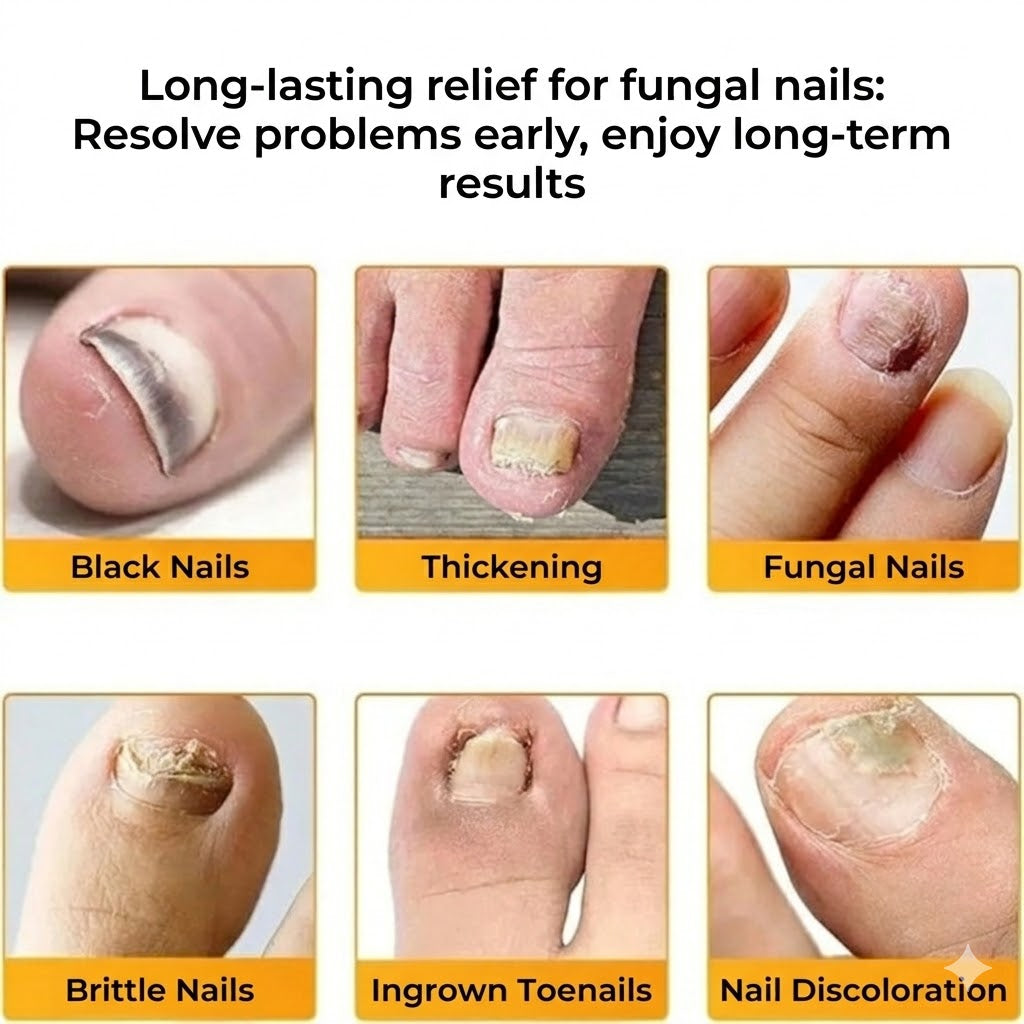 FungalPatch – Intensive Nail Care Set – Self-Adhesive Anti-Fungal Patches