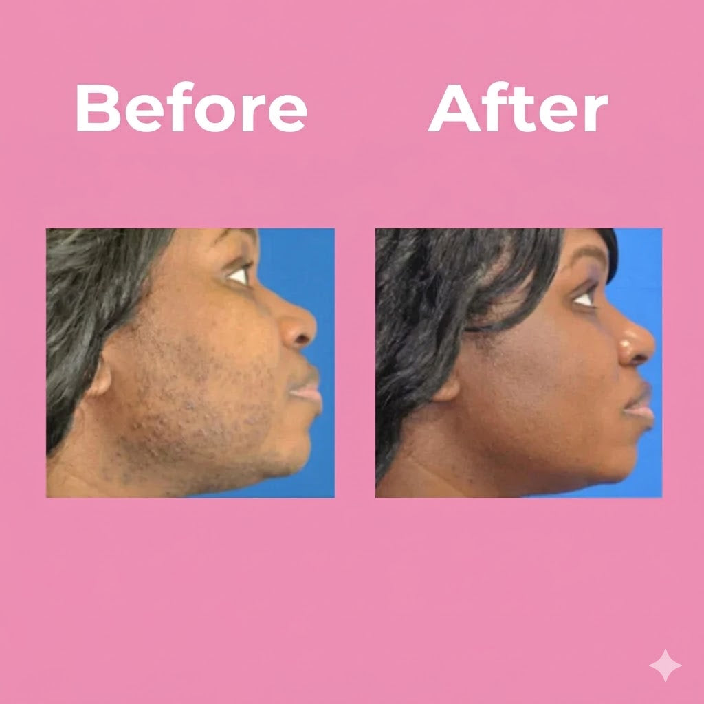 Professional Unisex Hair Removal Cream