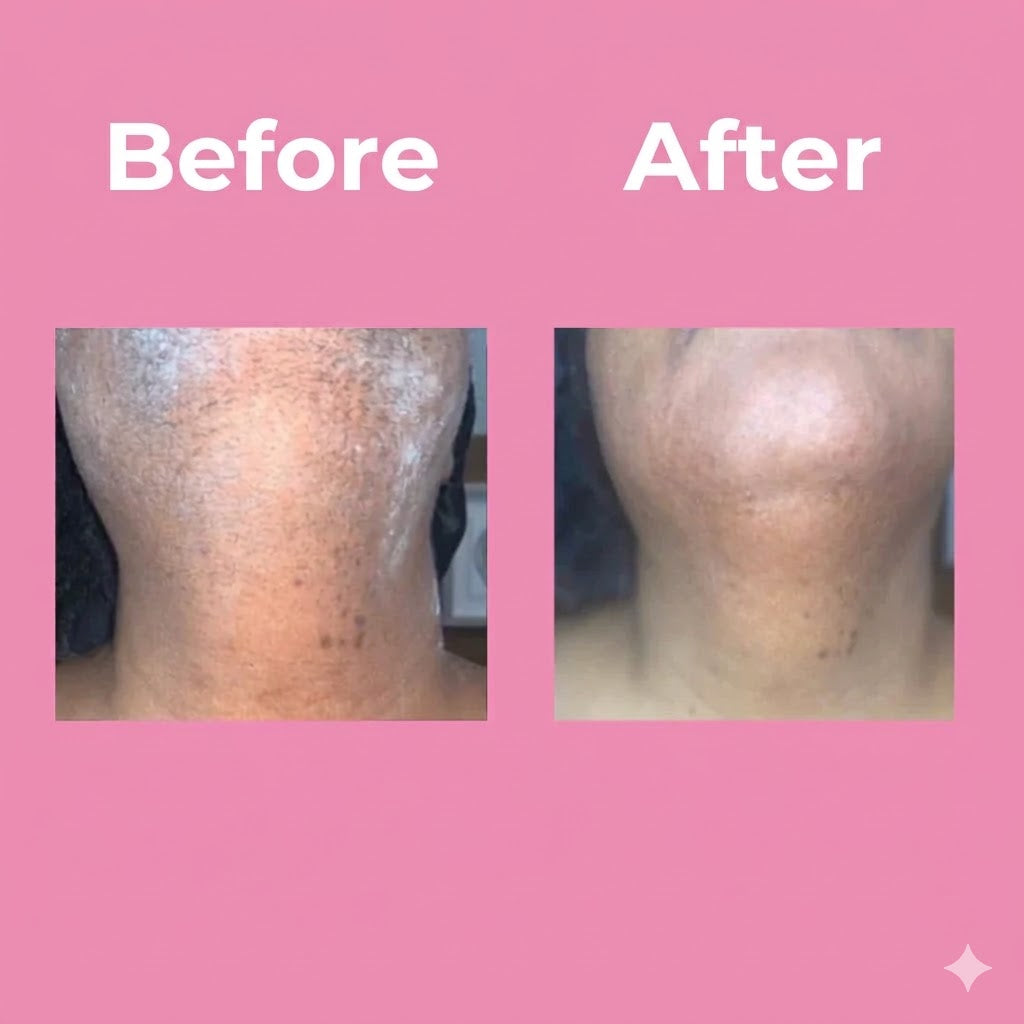 Professional Unisex Hair Removal Cream